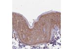 Immunohistochemical staining of human skin shows moderate to strong membranous positivity in squamous epithelial cells.