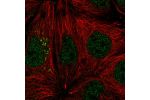 Immunofluorescent staining of human cell line CACO-2 shows localization to nucleoplasm & vesicles.