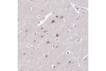 Immunohistochemical staining of human cerebral cortex shows moderate nuclear positivity in neuronal cells.