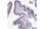 Immunohistochemical staining of human fallopian tube shows moderate nuclear positivity in glandular cells.