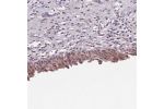 Immunohistochemical staining of human urinary bladder shows weak nuclear positivity in subset of urothelial cells.