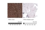 Immunohistochemical staining of human cervix, uterine shows moderate nuclear positivity in squamous epithelial cells.