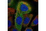 Immunofluorescent staining of human cell line A-431 shows localization to cytosol.