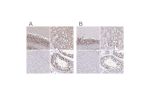 Immunohistochemical staining of human cerebellum, kidney, liver and testis using Anti-SIN3A antibody HPA047213 (A) shows similar protein distribution across tissues to independent antibody HPA062123 (B).