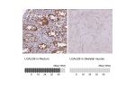 Immunohistochemistry analysis in human rectum and skeletal muscle tissues using HPA047218 antibody. Corresponding LGALS9 RNA-seq data are presented for the same tissues.