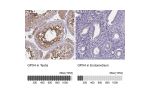 Immunohistochemistry analysis in human testis and pancreas tissues using Anti-GPX4 antibody. Corresponding GPX4 RNA-seq data are presented for the same tissues.