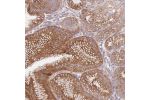 Immunohistochemical staining of human stomach, lower shows strong cytoplasmic and membranous positivity in glandular cells.