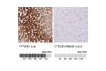 Immunohistochemistry analysis in human liver and skeletal muscle tissues using HPA047262 antibody. Corresponding CYP2A6 RNA-seq data are presented for the same tissues.