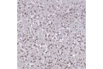 Immunohistochemical staining of human liver shows moderate nuclear positivity in hepatocytes.
