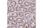 Immunohistochemical staining of human colon shows moderate cytoplasmic and nuclear positivity in glandular cells.