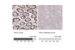 Immunohistochemistry analysis in human colon and skeletal muscle tissues using HPA047478 antibody. Corresponding TXN RNA-seq data are presented for the same tissues.