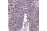 Immunohistochemical staining of human lymph node shows moderate granular cytoplasmic positivity in subset of non-germinal center cells.