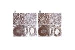 Immunohistochemical staining of human endometrium, kidney, lymphoid tissues and testis using Anti-SFPQ antibody HPA047513 (A) shows similar protein distribution across tissues to independent antibody HPA054689 (B).