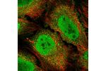 Immunofluorescent staining of human cell line HeLa shows localization to nucleoplasm, cytosol, midbody & vesicles.