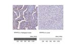 Immunohistochemistry analysis in human fallopian tube and liver tissues using HPA047629 antibody. Corresponding TPPP3 RNA-seq data are presented for the same tissues.