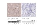 Immunohistochemistry analysis in human cerebral cortex and kidney tissues using HPA047634 antibody. Corresponding KCNC1 RNA-seq data are presented for the same tissues.
