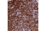 Immunohistochemical staining of human pancreas shows strong cytoplasmic positivity in exocrine glandular cells.
