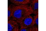 Immunofluorescent staining of human cell line A-431 shows localization to vesicles.