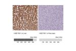 Immunohistochemistry analysis in human liver and pancreas tissues using HPA047729 antibody. Corresponding HSD11B1 RNA-seq data are presented for the same tissues.