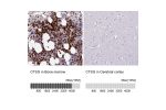 Immunohistochemistry analysis in human bone marrow and cerebral cortex tissues using HPA047737 antibody. Corresponding CTSG RNA-seq data are presented for the same tissues.