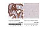 Immunohistochemistry analysis in human gallbladder and skeletal muscle tissues using HPA047784 antibody. Corresponding SHROOM3 RNA-seq data are presented for the same tissues.