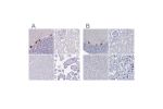 Immunohistochemical staining of human cerebellum shows moderate to strong positivity in Purkinje cells.
