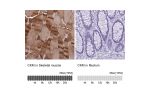 Immunohistochemistry analysis in human skeletal muscle and rectum tissues using HPA047859 antibody. Corresponding CKM RNA-seq data are presented for the same tissues.