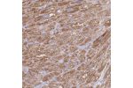 Immunohistochemical staining of human testis shows distinct cytoplasmic positivity in Leydig cells.