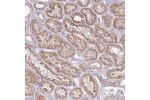 Immunohistochemical staining of human kidney shows moderate cytoplasmic positivity in renal tubules.