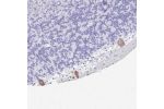 Immunohistochemical staining of human cerebellum shows moderate cytoplasmic positivity in Purkinje cells.