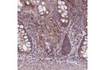 Immunohistochemical staining of human rectum shows moderate positivity in stroma cells.