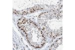 Immunohistochemical staining of human testis shows strong nuclear positivity in a subset of cells.