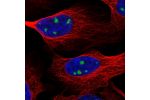 Immunofluorescent staining of human cell line U-2 OS shows localization to nucleoli.