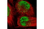 Immunofluorescent staining of human cell line U-251 MG shows localization to nucleoplasm & vesicles.