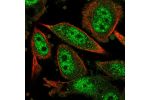Immunofluorescent staining of human cell line PC-3 shows localization to nucleoplasm & cytosol.