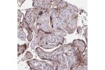 Immunohistochemical staining of human lymph node shows moderate to strong cytoplasmic positivity in macrophages.