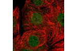 Immunofluorescent staining of human cell line MCF7 shows localization to nucleoplasm.
