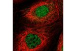 Immunofluorescent staining of human cell line A-431 shows localization to nucleoplasm.