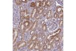 Immunohistochemical staining of human kidney shows moderate cytoplasmic positivity in cells in tubules.