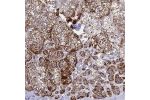 Immunohistochemical staining of human adrenal gland shows strong cytoplasmic positivity in glandular cells.