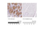 Immunohistochemistry analysis in human stomach and skeletal muscle tissues using HPA048284 antibody. Corresponding LYZ RNA-seq data are presented for the same tissues.
