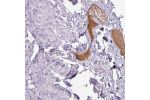 Immunohistochemical staining of human rectum shows positivity in plasma.