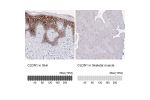 Immunohistochemistry analysis in human skin and skeletal muscle tissues using HPA048319 antibody. Corresponding CLDN1 RNA-seq data are presented for the same tissues.