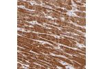 Immunohistochemical staining of human heart muscle shows strong cytoplasmic positivity in myocytes.