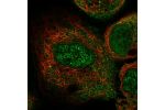 Immunofluorescent staining of human cell line A-431 shows localization to nucleoplasm, cytosol & cell junctions.
