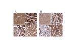 Immunohistochemical staining of human cerebral cortex, heart muscle, kidney and liver using Anti-ATP5H antibody HPA048459 (A) shows similar protein distribution across tissues to independent antibody HPA042777 (B).