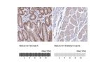 Immunohistochemistry analysis in human stomach and skeletal muscle tissues using HPA048483 antibody. Corresponding ABCC3 RNA-seq data are presented for the same tissues.