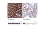 Immunohistochemistry analysis in human liver and testis tissues using HPA048492 antibody. Corresponding GCDH RNA-seq data are presented for the same tissues.