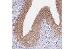 Immunohistochemical staining of human urinary bladder shows moderate nuclear and cytoplasmic positivity in urothelial cells.