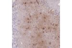 Immunohistochemical staining of human hippocampus shows moderate cytoplasmic positivity in glial cells.